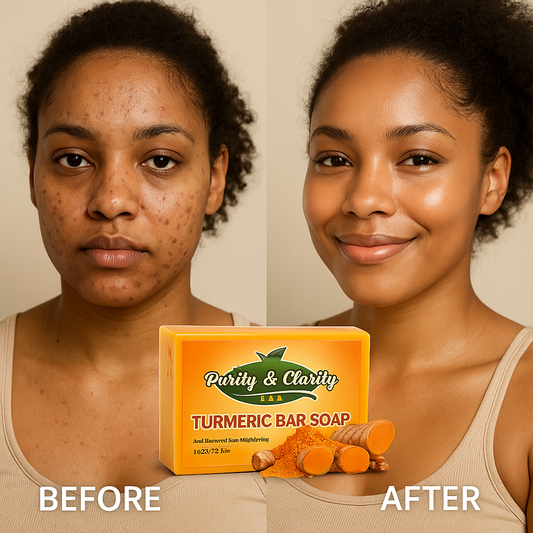 Turmeric Bar Soap – 200g - Purity & Clarity, LLC