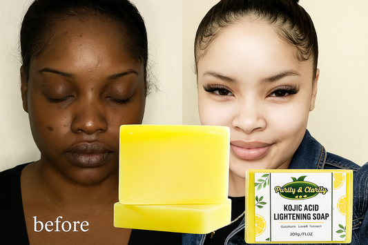 Kojic Acid Lightening Soap – 200g - Purity & Clarity, LLC