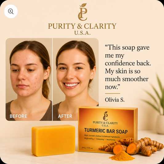 Turmeric Bar Face & Body Bar Soap – 200g